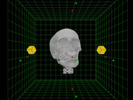 Example of Depth in 3D Visualization of the Skull