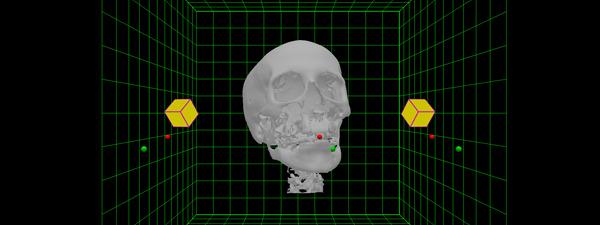 Example of Depth in 3D Visualization of the Skull